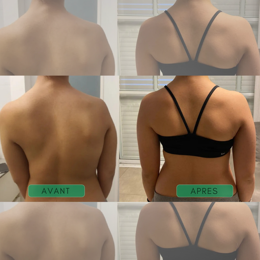 Posture+ - Soutien Postural Instantané