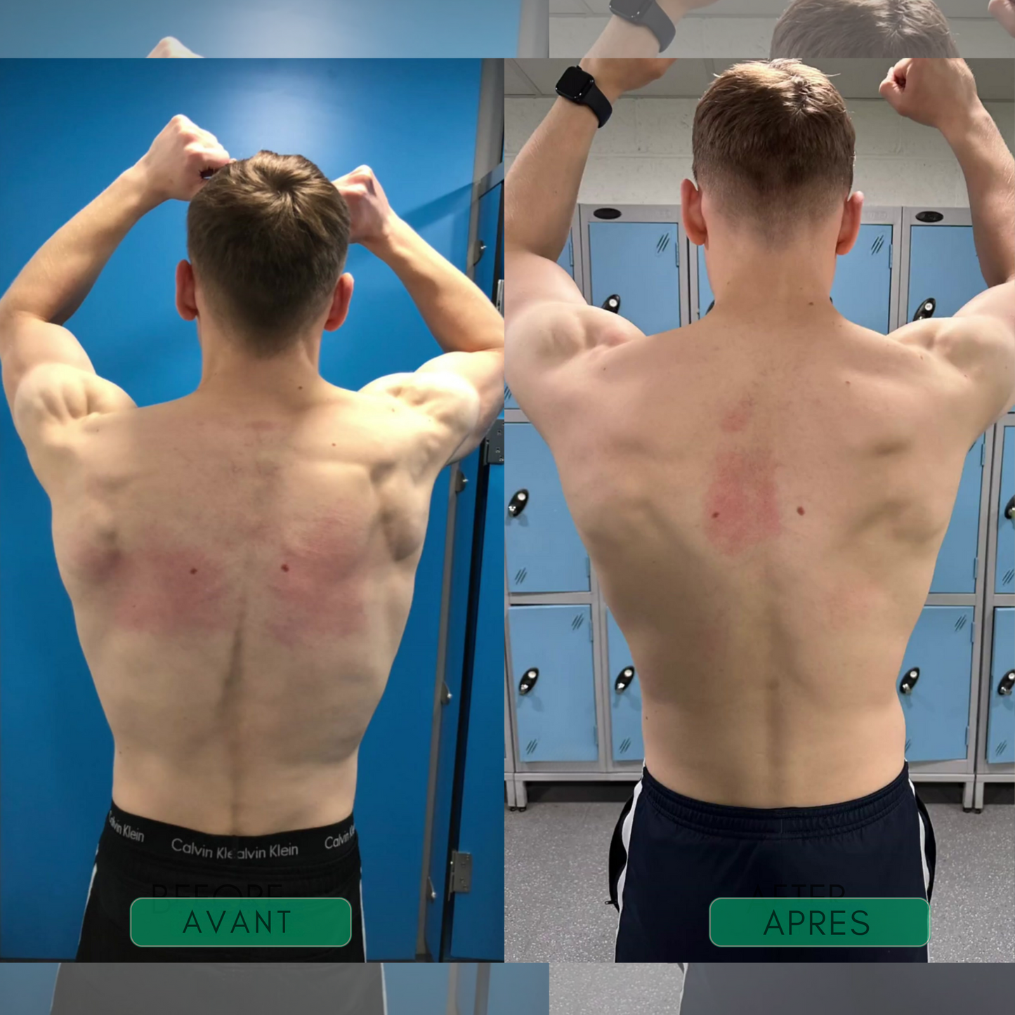 Posture+ - Soutien Postural Instantané